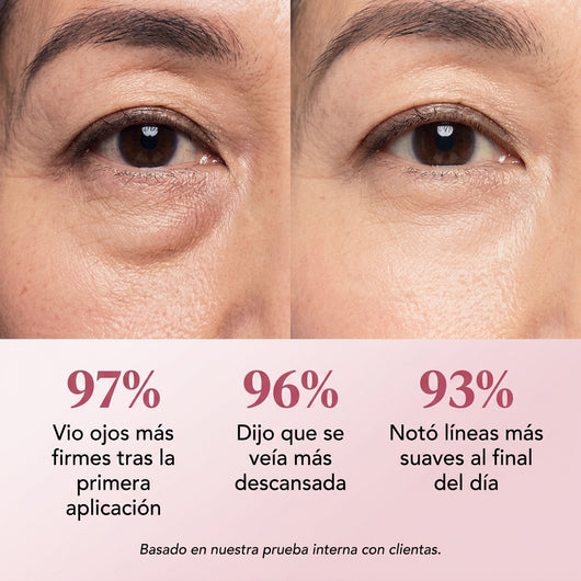 Tensor Instantáneo de Contorno de Ojos