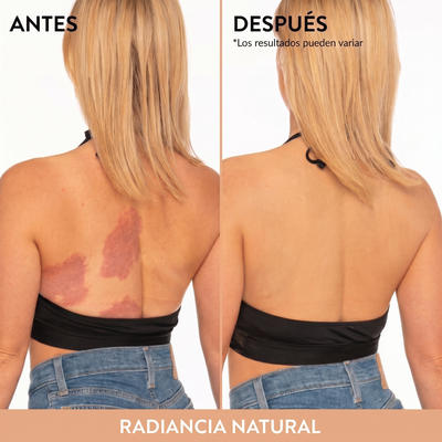 Perfecteur de Cobertura Corporal