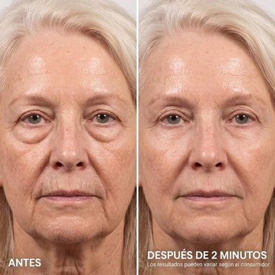 Tensor Instantáneo de Contorno de Ojos